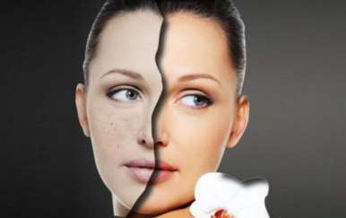 簡單的祛痘方法，讓你的皮膚時刻光滑細嫩